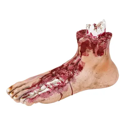 Avhuggen Fot med Köttsår