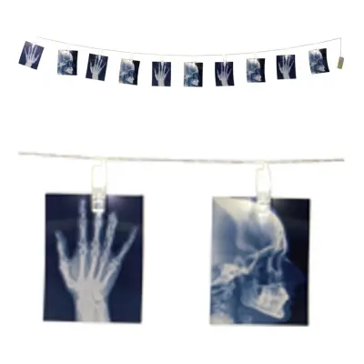 Girlang med LED-belysning Röntgen