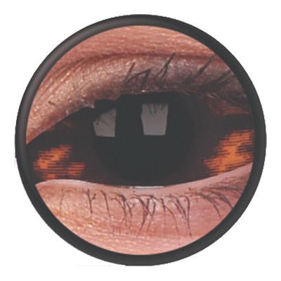 Scleralinser Morbius