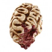 Hjärna med Köttsår